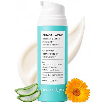 BellamiLuxx Loción para tratamiento del acné fúngico: crema eficaz para granos para rostro y cuerpo para protuberancias, racimos, picazón y enrojecimiento - Hidratante para tratamiento del acné de piel propensa a hongos para adolescentes y adultos con acti